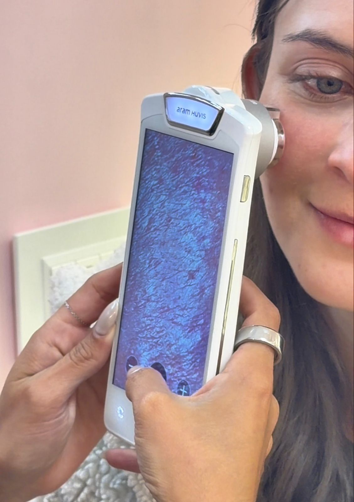 Análisis Facial